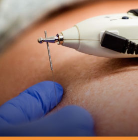 traumakingperu-carrousel-fisioterapia-invasiva